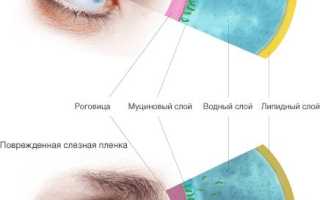 Чем лечить синдром сухих глаз