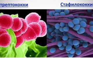 Пиодермия лица код мкб