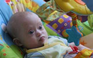 Symbol down syndrome символ синдрома дауна