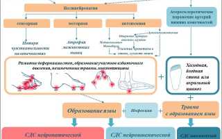 Синдром диабетической стопы этиология патогенез