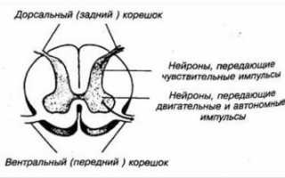Как лечить остеохондроз с корешковым синдромом