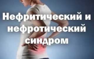 Чем отличается нефротический синдром от нефритического синдрома