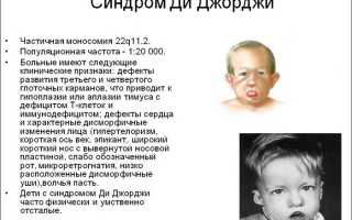 Синдром ди джорджи продолжительность жизни