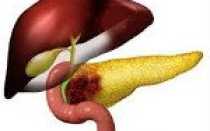 Код диагноза по мкб с25