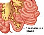 Илеит