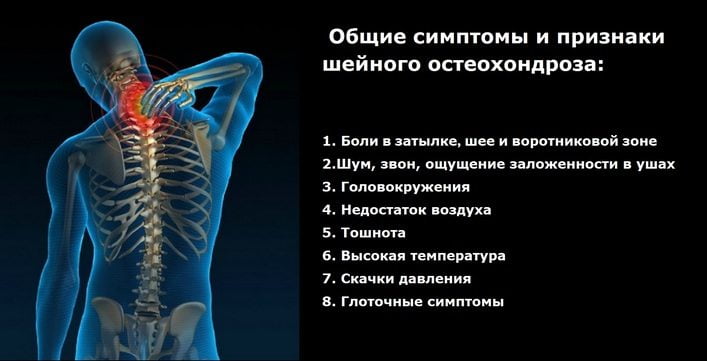 Корешковые синдромы при поясничном остеохондрозе чем лечить