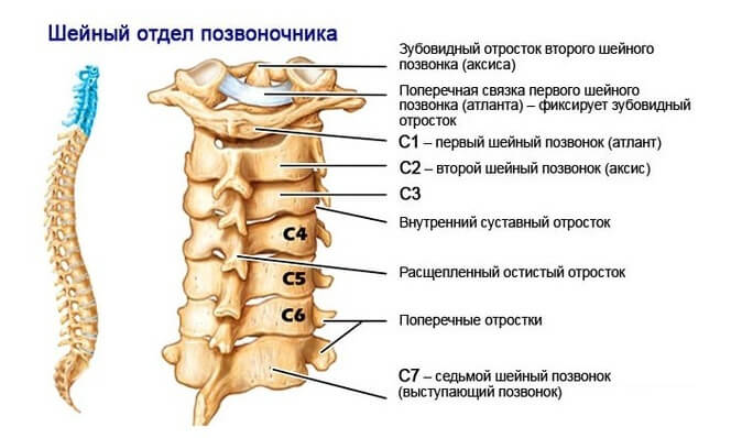 Что такое грыжа шейного отдела