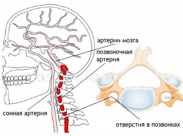 Расположение позвоночных артерий Расположение артерий