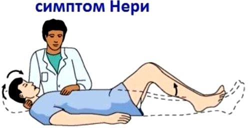 Корешковые синдромы при поясничном остеохондрозе чем лечить