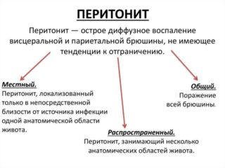 Каловый перитонит код мкб