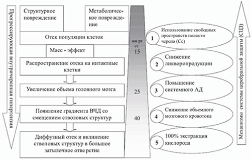 Внутричерепная гипертензия